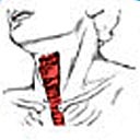 Local na região cervical onde é realizada a incisão (corte) cirúrgica e para a realização de uma mediastinoscopia.